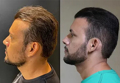 case hygor guerreiro